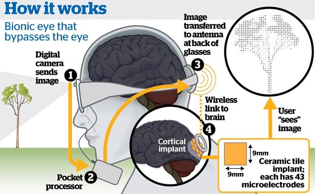 How one version of the bionic eye works