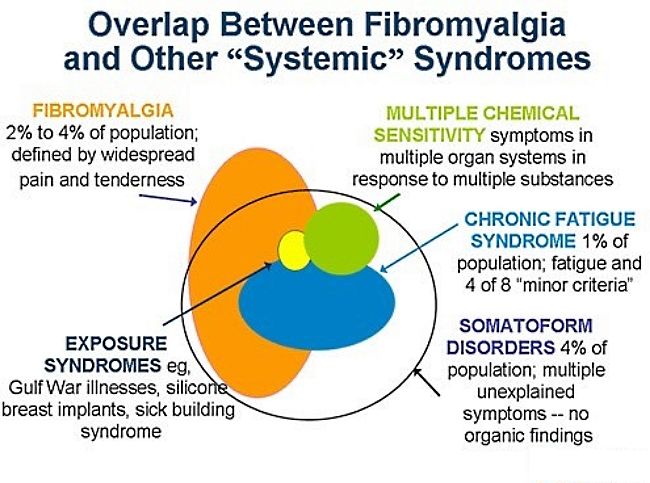 Chronic Fatigue Syndrome - Symptoms and Characteristics - Image 6