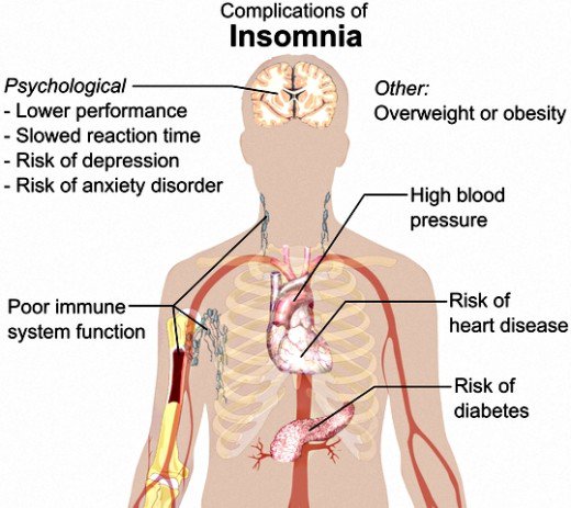Insomnia can have many related complications