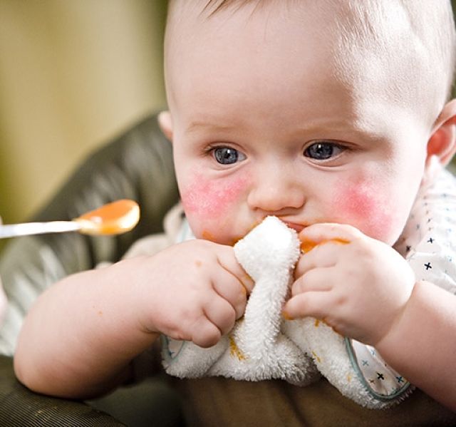 Egg allergy symptoms are easily confused with other causes. Learn more about it here