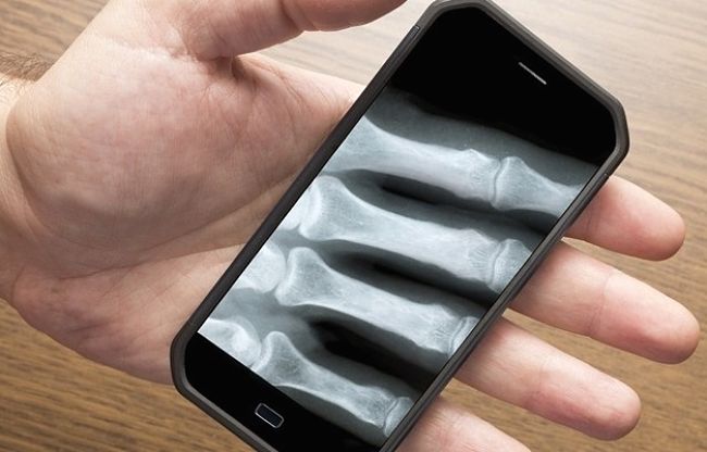 There are many smartphone tools that can be used remotely to help with diagnosis of problems