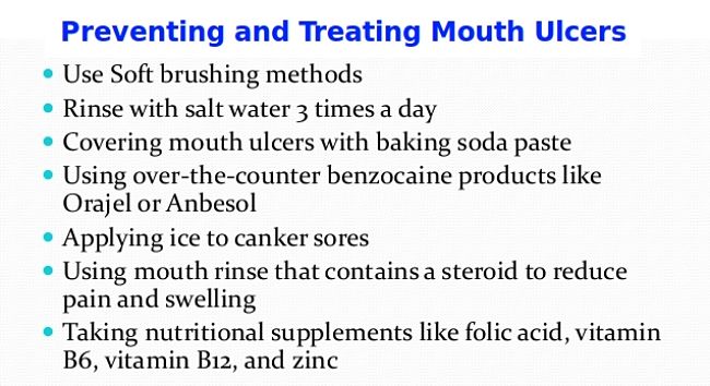 How to prevent and control mouth ulcers