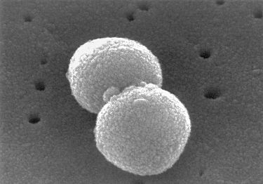 Streptococcus pneumoniae - the common cause of sore throats