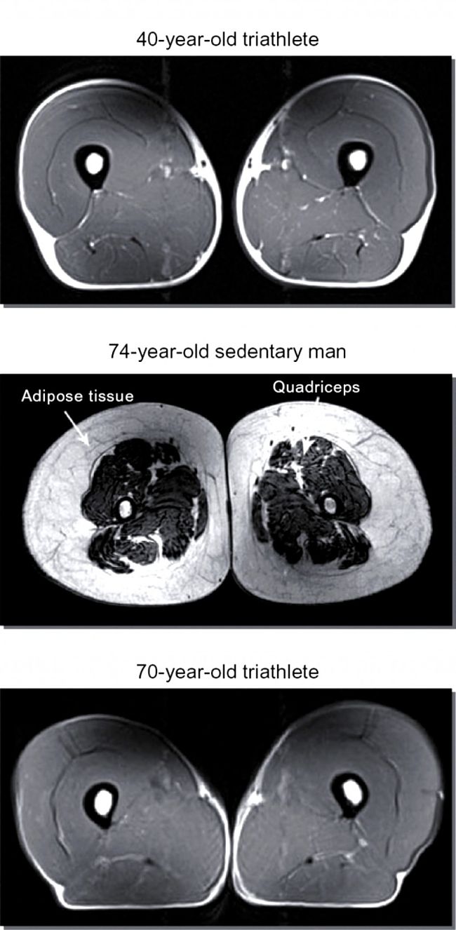 MRI scans show how muscle mass changes with age